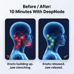 DeepNode™
